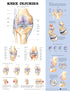 Knee Injuries