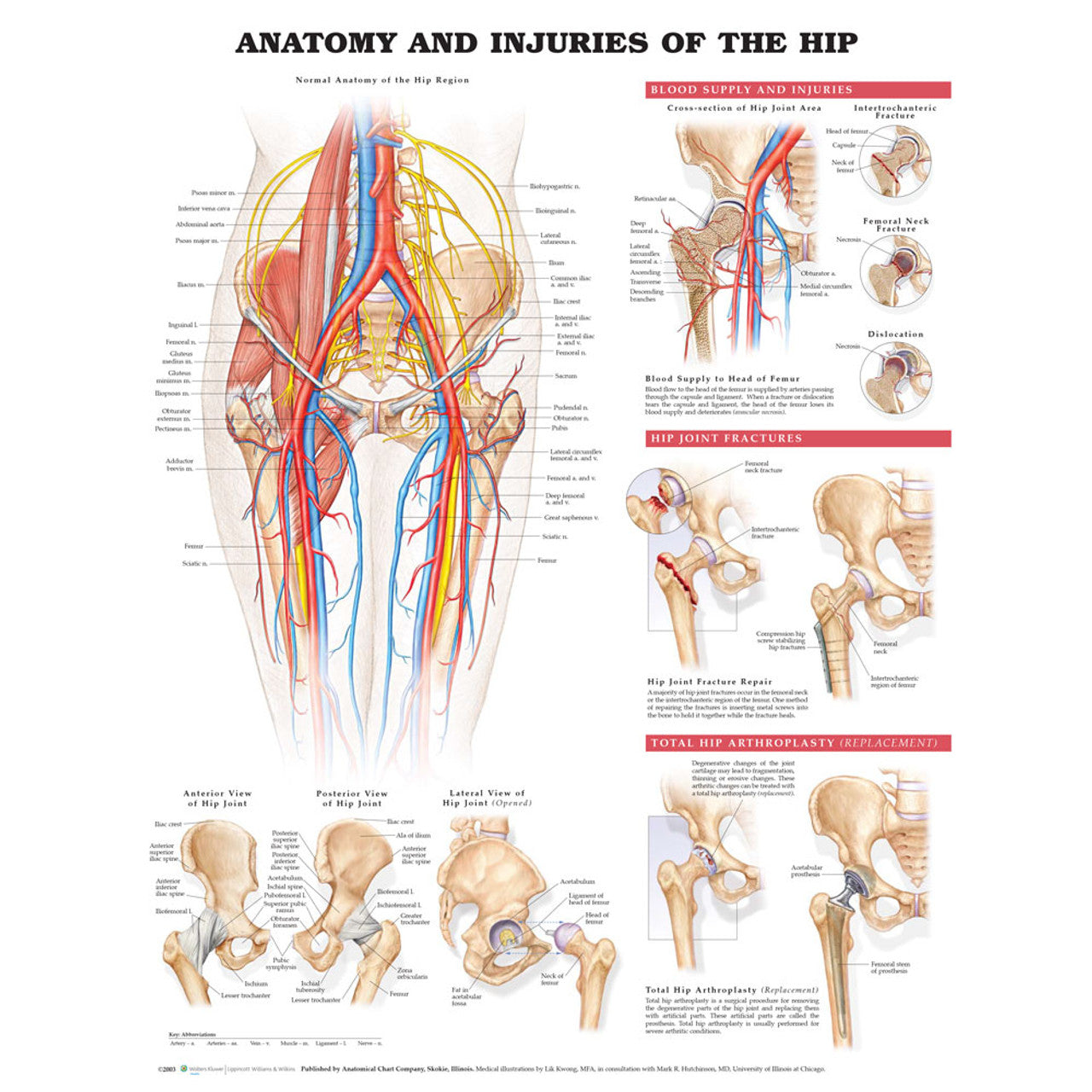 Anatomy and Injuries of the Hip (Laminated) - physio supplies canada