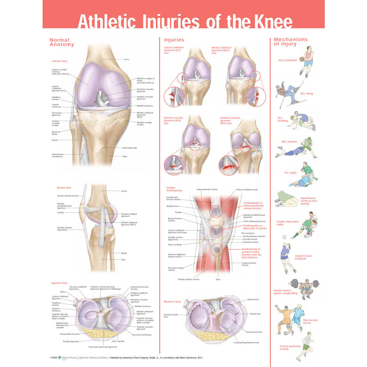 Athletic Injuries of the Knee ( Laminated) - physio supplies canada